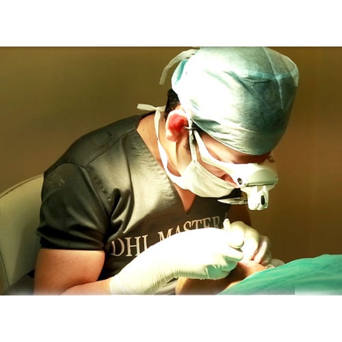 Best Hair Transplant Clinics and Doctors