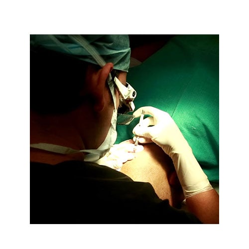 Hair Extraction at DHI