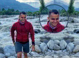 Rajat Hair Transplant Journey at DHI 