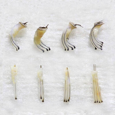  Graft Hair Transplant Procedure