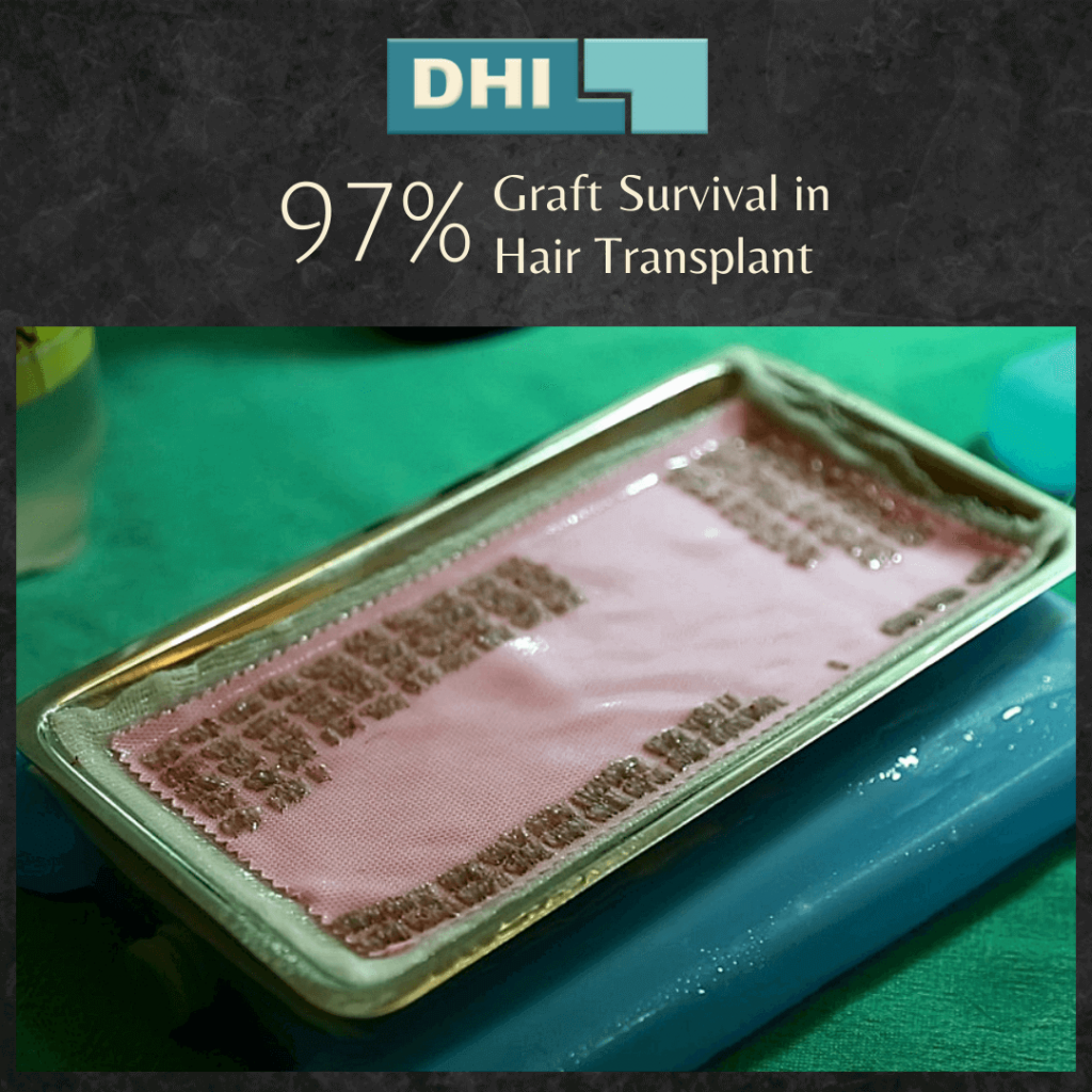DHI 97% Graft Survival in Hair Transplant