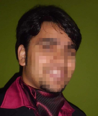 Rohan Hair Transplant at DHI India