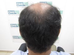 Before the Procedure