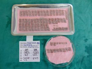 Hair Transplant Graft Tray