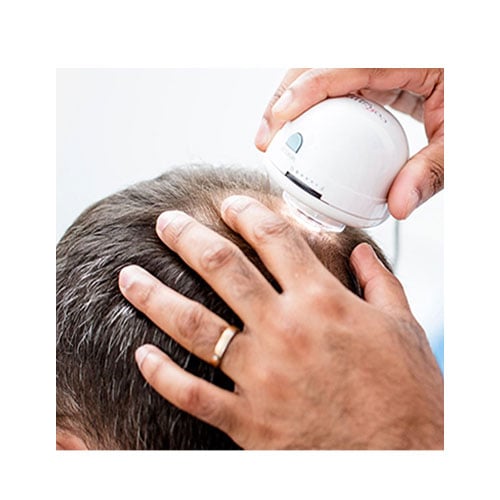 Hair Loss Consultation