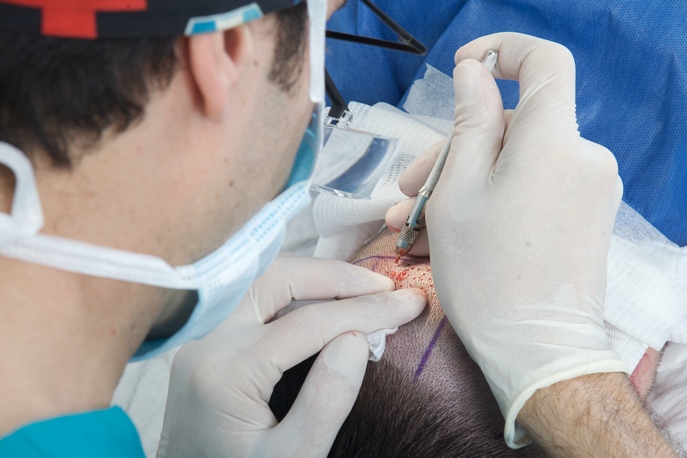 Hair Transplant Donor