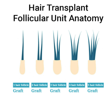 Hair Transplant Follocular Unit Anatomy