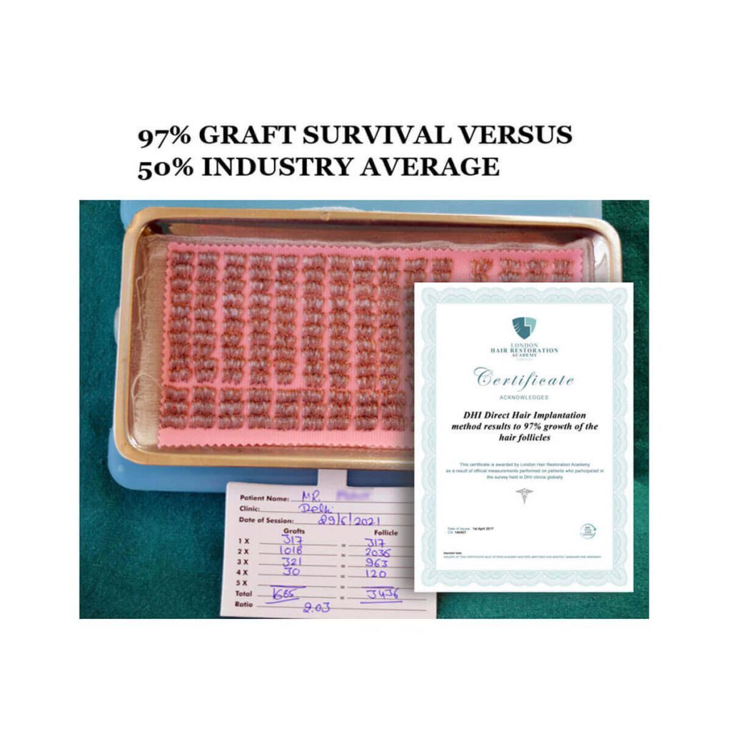 Hair Transplant Graft Tray