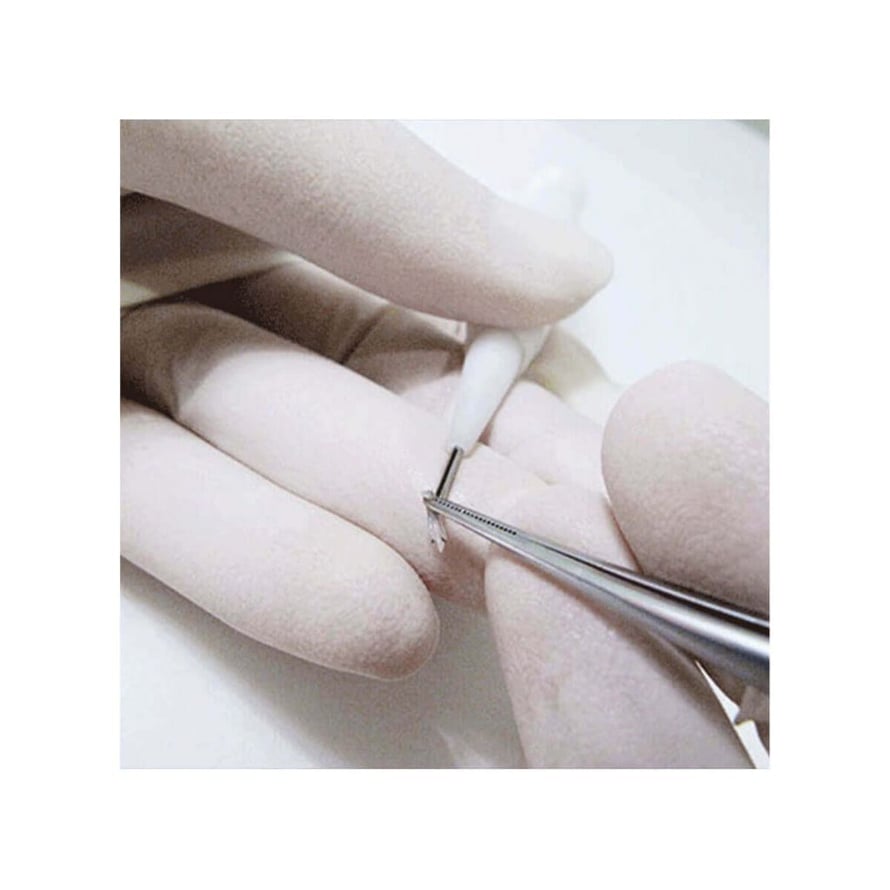 DHI Hair Transplant Advanced Procedures