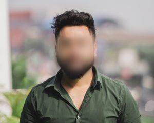 After DHI Hair Transplant Results