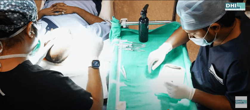 Hair Transplant Surgery Procedure