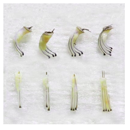 Advanced Direct hair implantation Technique