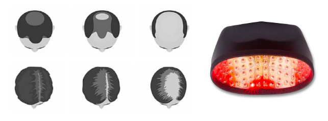 DHI Laser Cap for Women