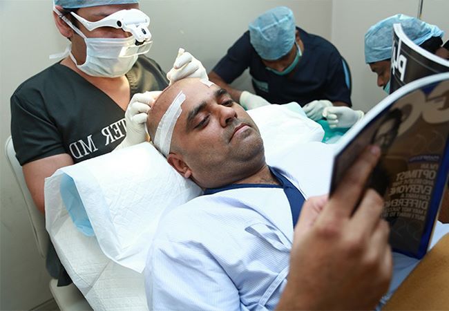 Hair Transplant at DHI Clinic