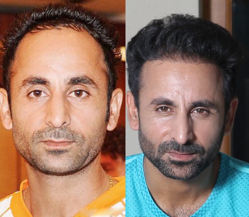 Before & After Results - DHI India