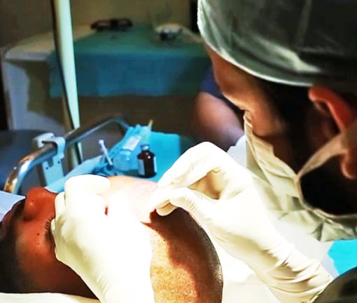 Hair Restoration at DHI Clinic