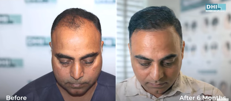 Mr. Suresh Kumar after 6 month results