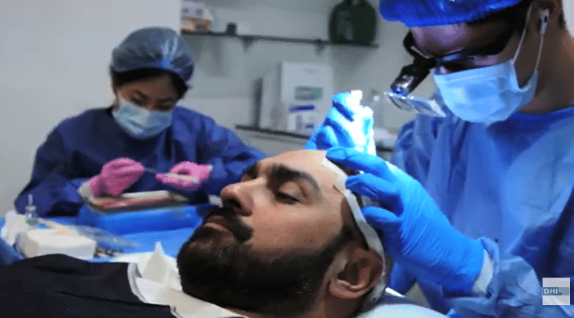 Mr. Ahmed Elmohamady’s Hair Transplant Journey