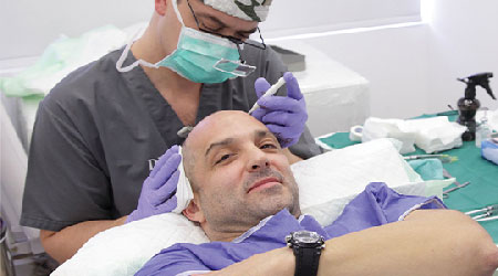 Hair Transplant Advanced Technology