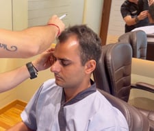 DHI Hair Treatment Procedure